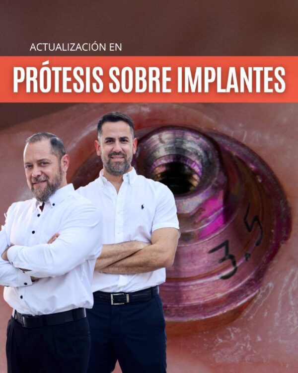 PRÓTESIS SOBRE IMPLANTES: El Paso a Paso - Dr. Juan Ignacio Bejarano y Prof. Dr. Rubén Ayala Semidei [Cuota 1/4]